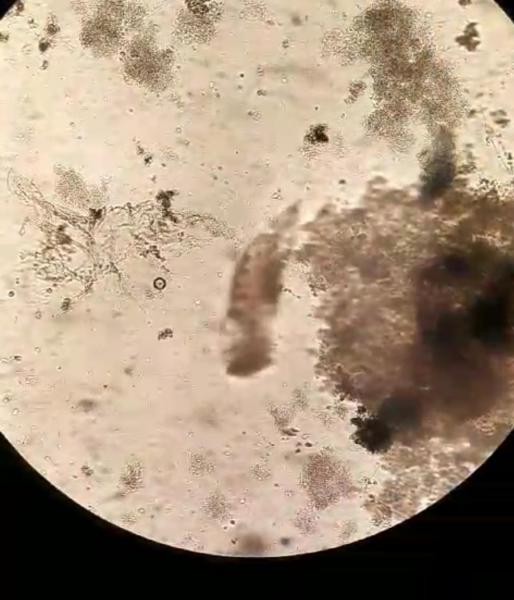 Mikroskopieren Ansatz